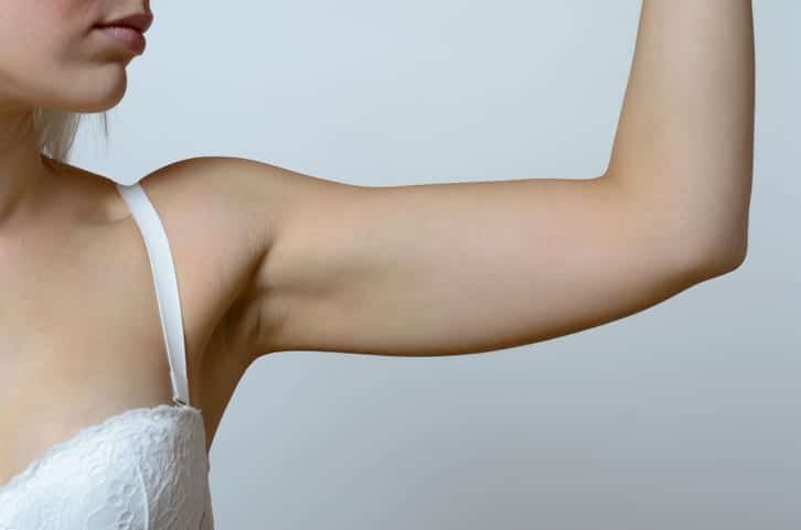 Arm Lift