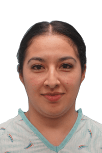 Before Image: Rhinoplasty