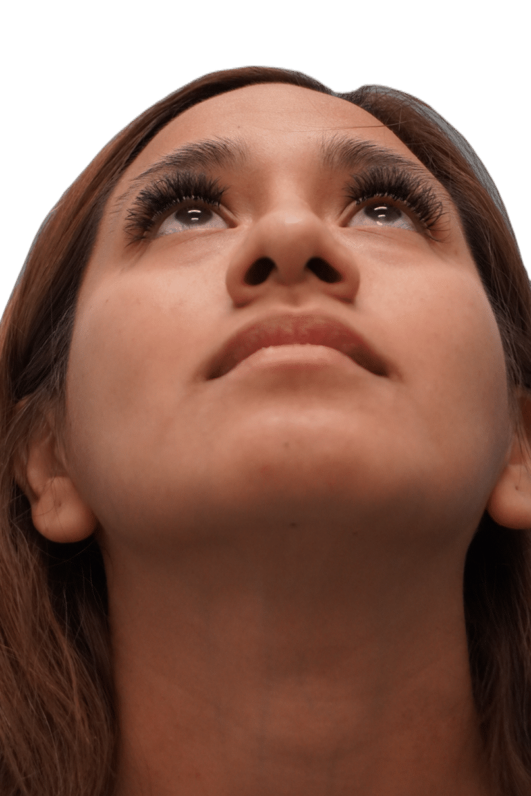 Before Image: Rhinoplasty - front
