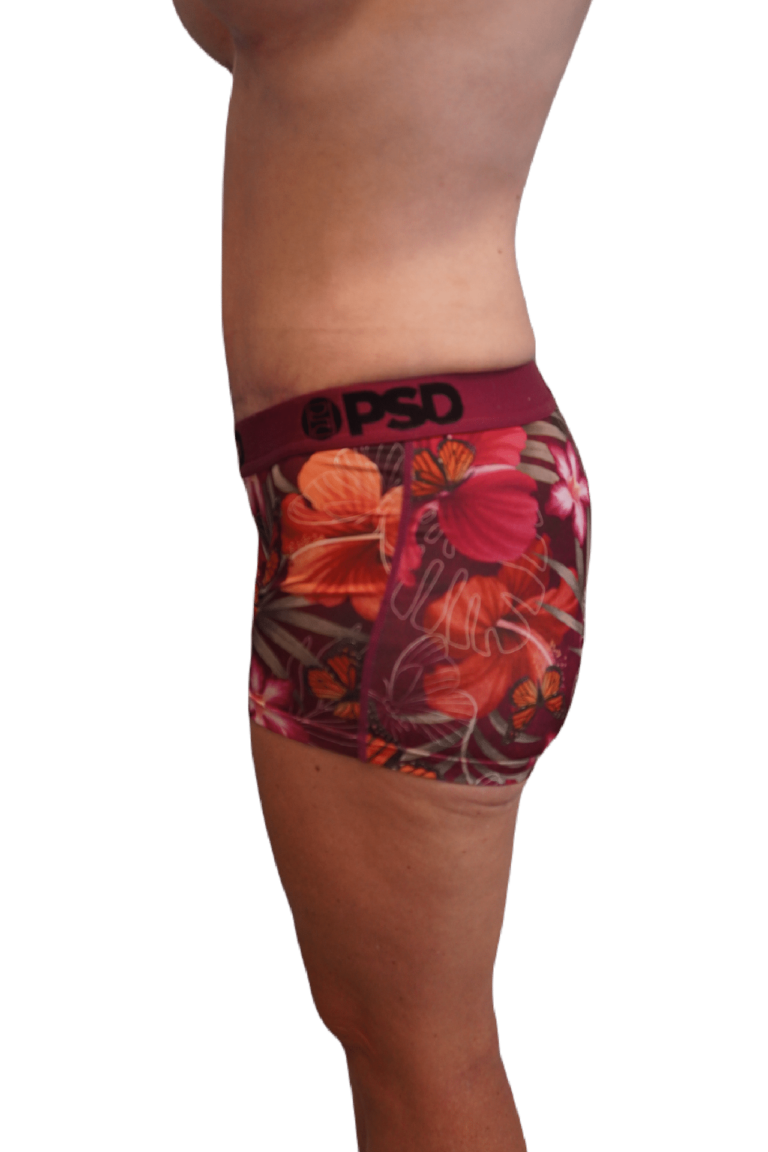 After Image: Tummy Tuck - left-side