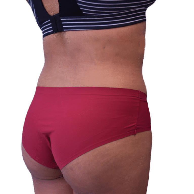 After Image: BBL - right-back-oblique