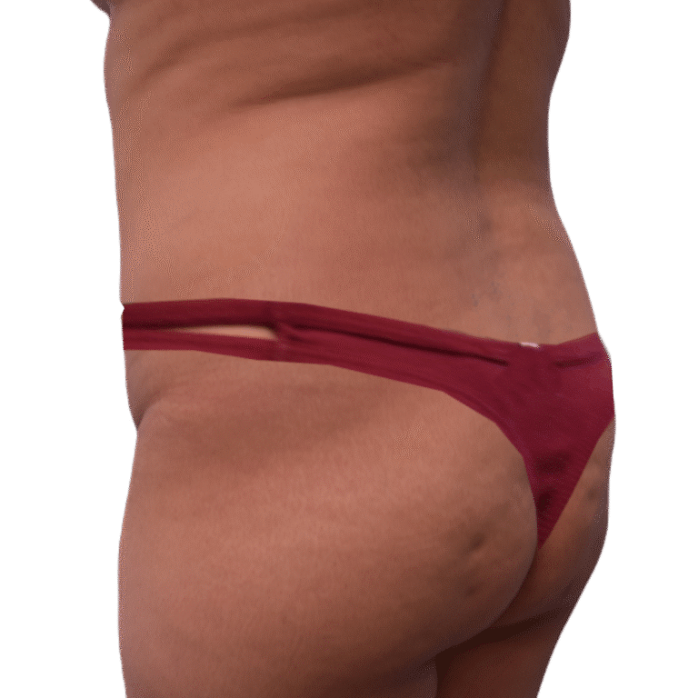 Before Image: BBL - left-back-oblique