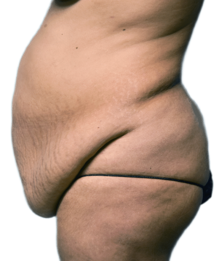 Before Image:  - left-side