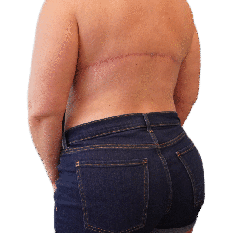 After Image: Back Tuck - left-back-oblique