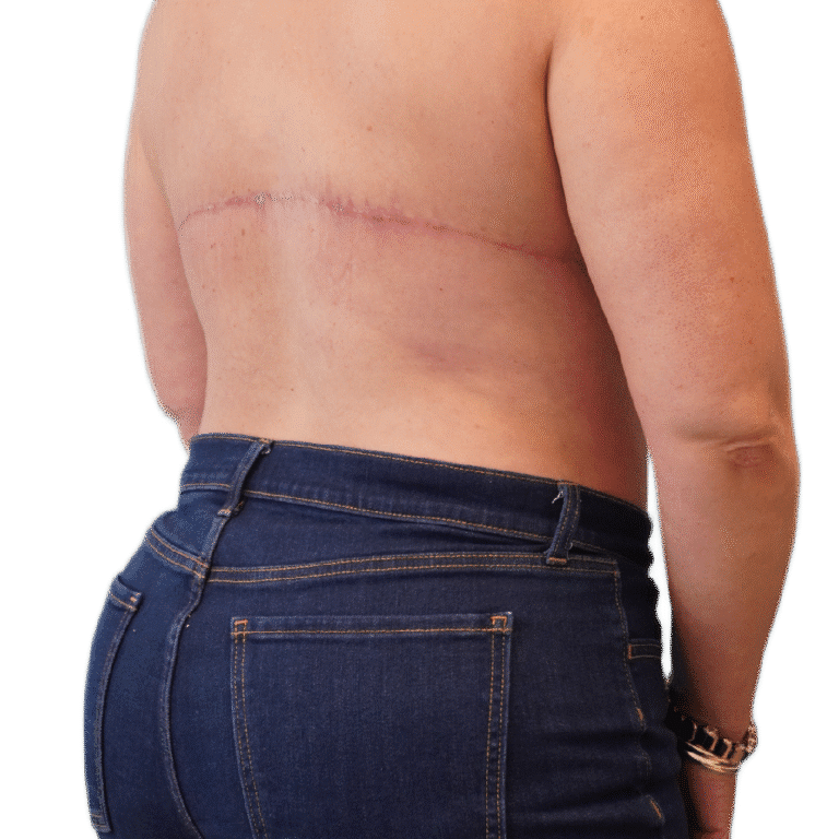 After Image: Back Tuck - right-back-oblique