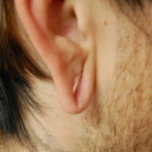 Before Image: Gauged Ear Repair