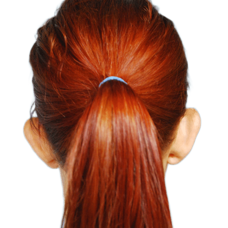 Before Image: Otoplasty (ears) - back