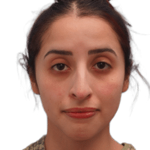 Before Image: Rhinoplasty