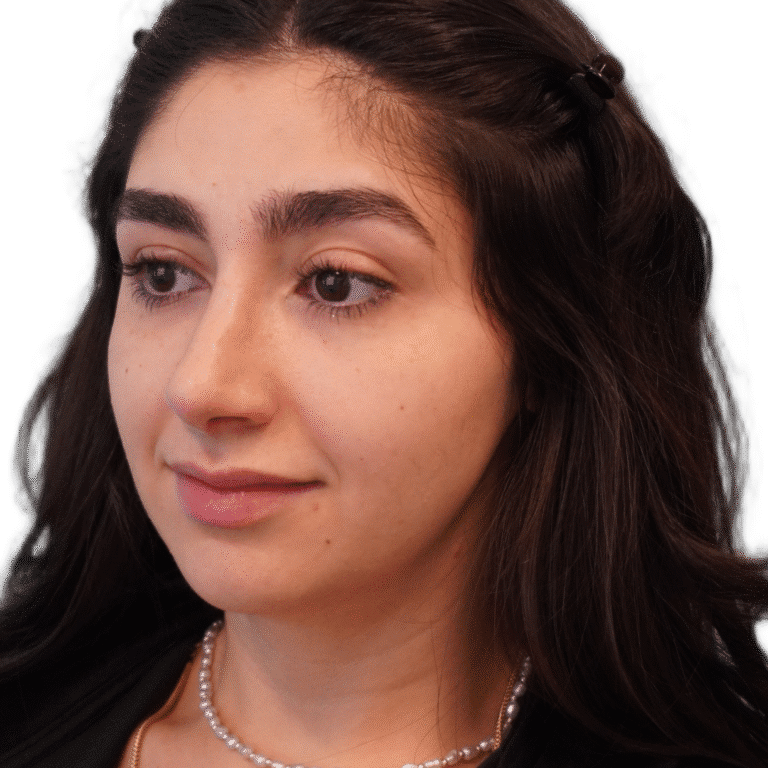 After Image: Rhinoplasty - left-front-oblique