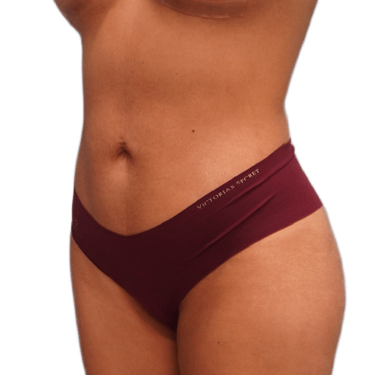 After Image: BBL - left-front-oblique